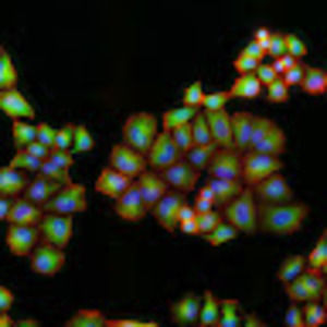 Meet your Posher, Agnes